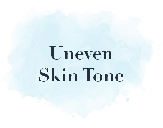 Uneven Skin Tone