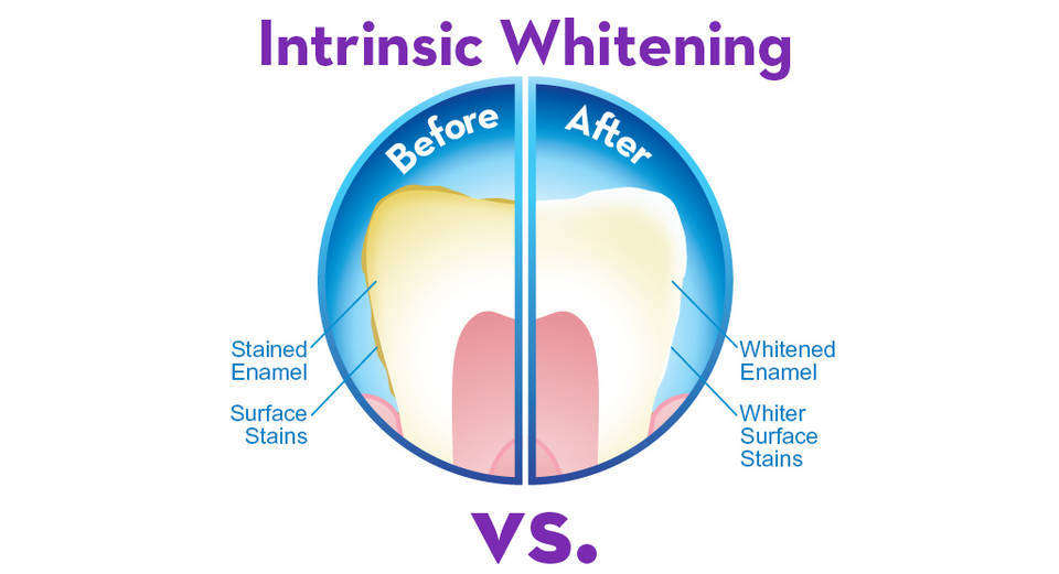 Crest 3D White Intensive Professional Effects Teeth