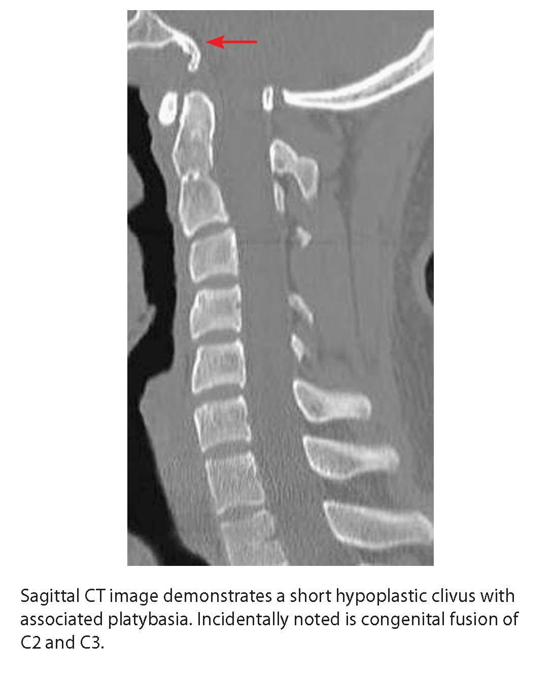 Radiology Case Review Series Spine 8601423638683