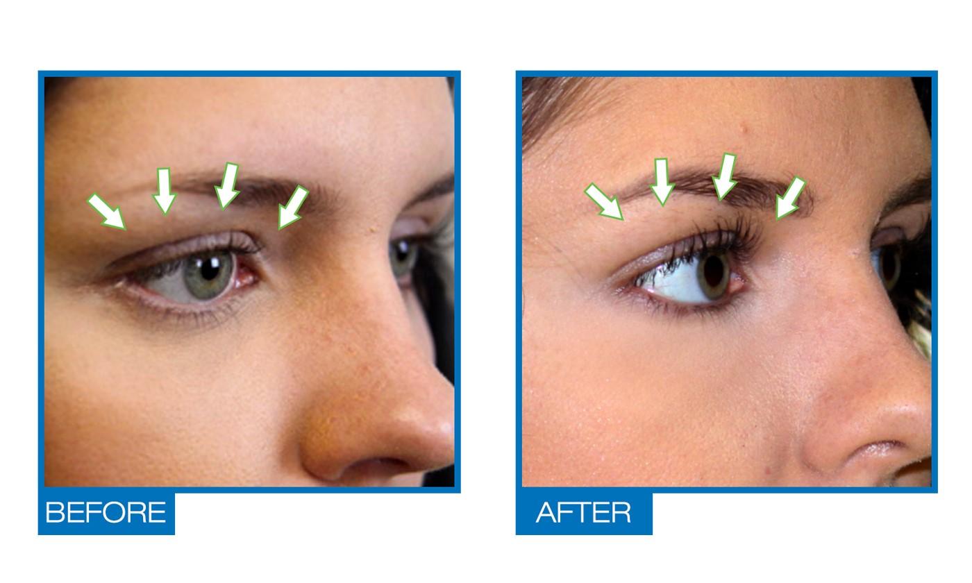 after and makeup before natural Serum & Eyelash Omiera Growth Growth Eyebrows Amazon.com: after and makeup before natural Serum & Eyelash Omiera Growth Growth Eyebrows Amazon.com: