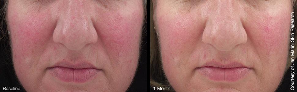 jan marini reviews 2019