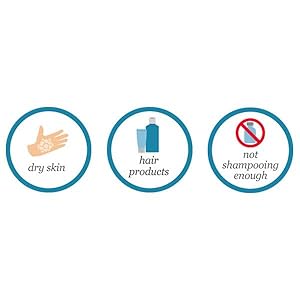 What Causes Dandruff?