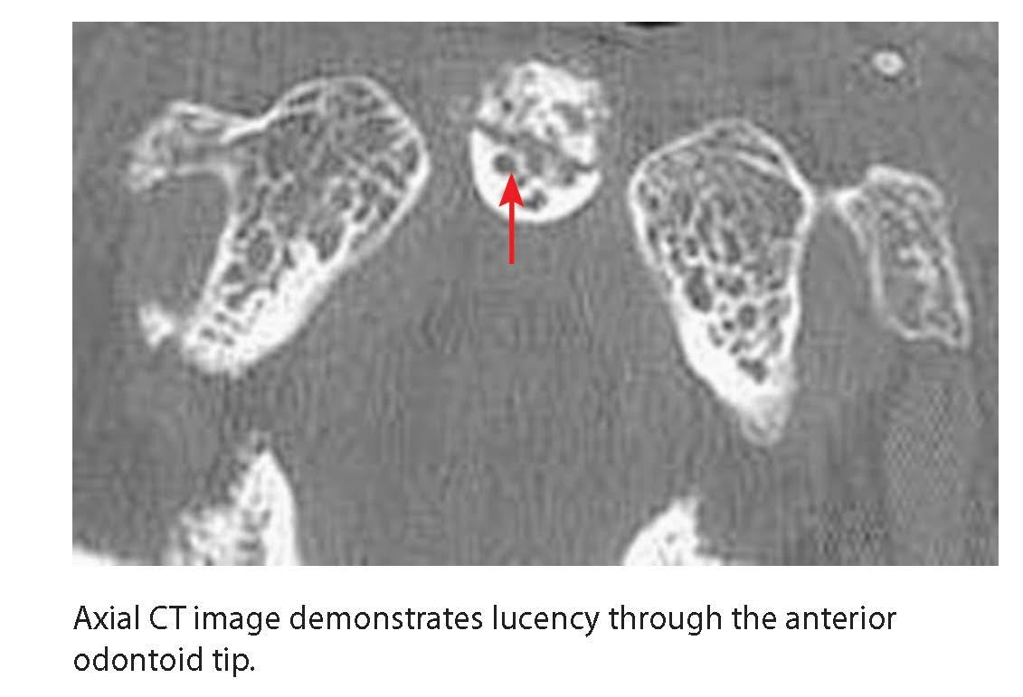 Radiology Case Review Series Spine 8601423638683