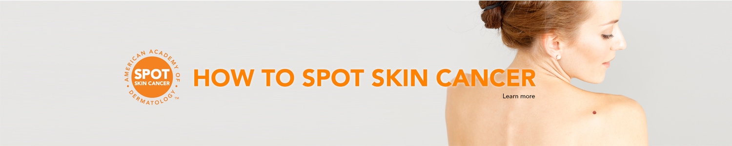 SPOT Skin Cancer