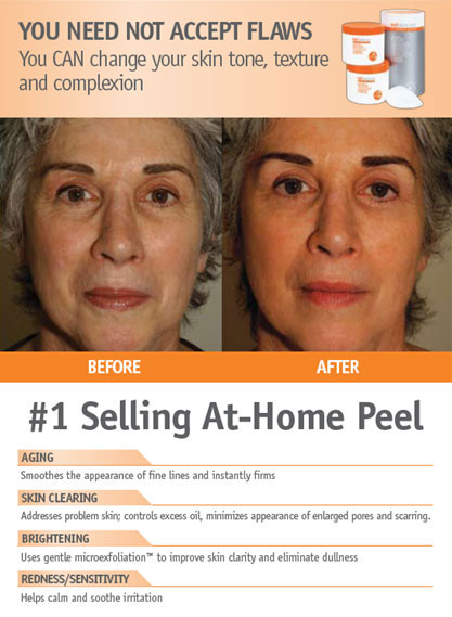 dr gross face peel