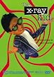 Watch The X-Ray Kid Online Free