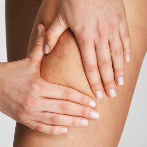 vakuummassager_anticellulite