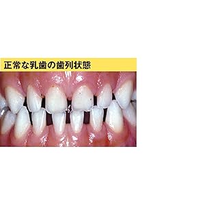 Amazon チュチュ おしゃぶり 出っ歯になりにくい デンティスター1 授乳期用 ベビー マタニティ ベビー マタニティ 通販