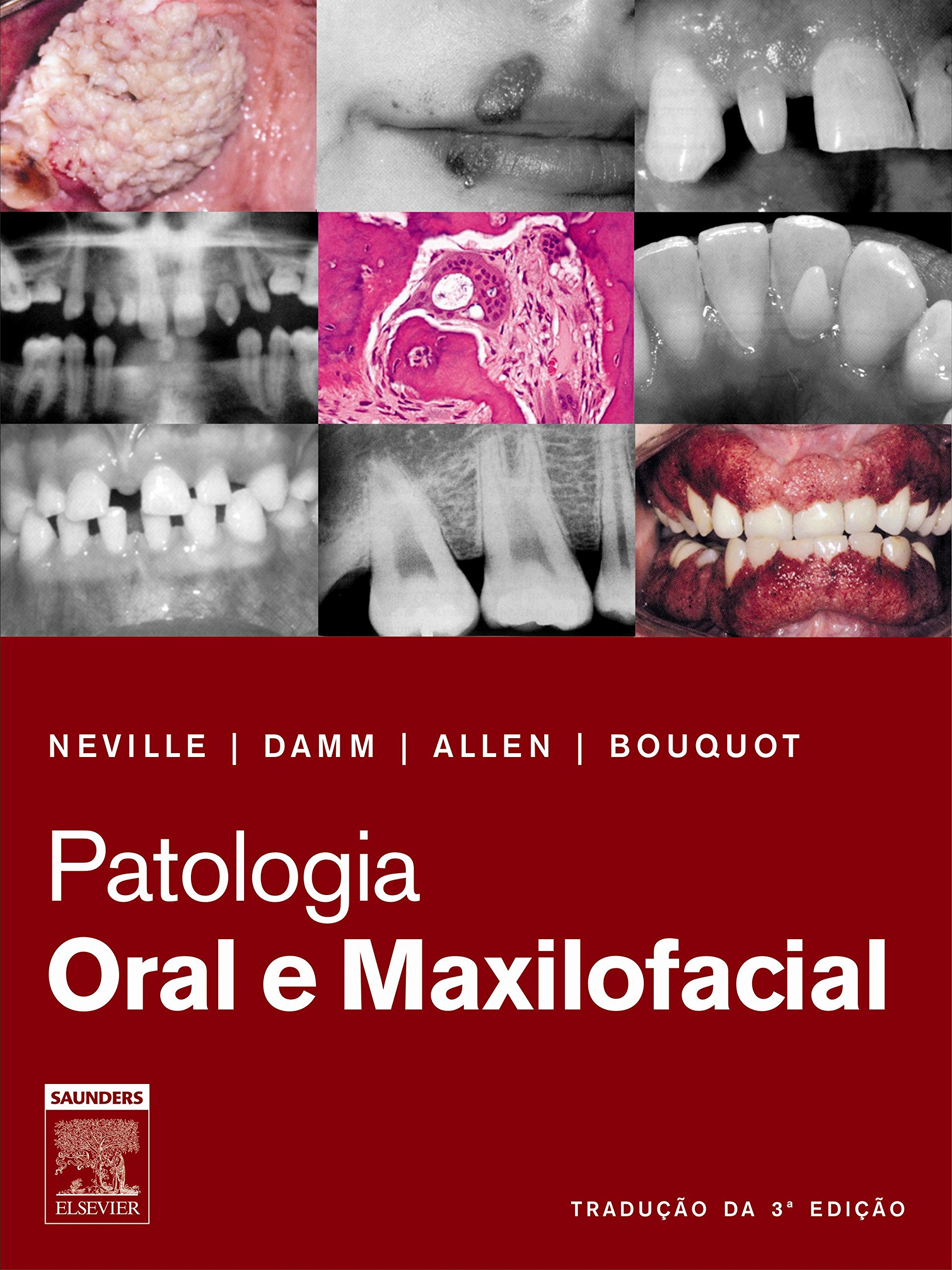 Patologia Oral