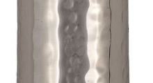 Yair Emanuel Mezuzah Case Holder Hammered Metal Designed with Colored Rings 12cm (Silver Rings)