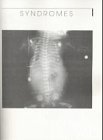 Casebase in Pediatric Radiology : "The Baby Minnie of Pediatric Radiology", Seibert, Joanna J. and James, Charles A., 313107891X