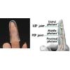 Open Air Stax Finger Splint Size #1