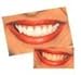 Professional Dental Strength 35% FAST ACTING Teeth Whitening Gel. Includes 4 XL 10cc Syringes of Whitening Gel! Up TO 120 Applications! Made in USA!