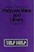 Nature Cure Treatment for Varicose Veins and Ulcers (Self-help)