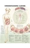Understanding Cancer Anatomical Chart, Anatomical Chart Company Staff, 1587797615