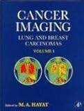 Cancer Imaging, Hayat, M. A., 0123742129