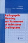 Radiographic Planning and Assessment of Endosseous Oral Implants, Jacobs, Reinhilde and Van Steenberghe, D., 3540630872