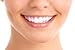 SparkleBrite - 1st Class Edition - Professional 3D At Home Teeth Whitening Kit - Let your Smile Sparkle Again!
