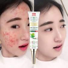 face clean cream for pimple