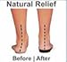 Orthaheel Mens/Womens Wave Sandals (Mens 11 Womens 12, Black)