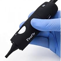 Amazon.com: Firefly DE500 Digital Video Otoscope Ear Camera for ...
