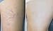 K MAX- Maximim Strength Vitamin K 5% Cream for Stretch Marks, Spider Veins, Acne Scars, Broken Capillaries, Rosacea, Puffy Dark Eye Circles, bruises- Works on Legs, Arms, Face, Nose (2oz)