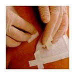 Smith and Nephew Remove Adhesive Remover Wipes 403100, 50-count by Smith & Nephew