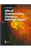 Atlas of Posterior Fundus Changes in Pathologic Myopia, Tokoro, T., 4431702253