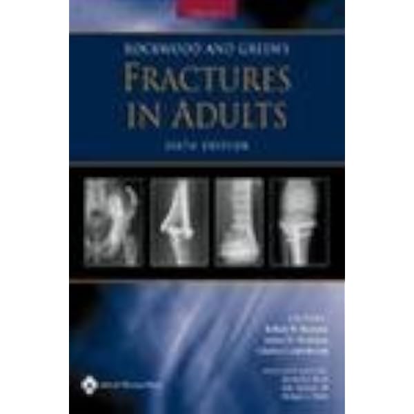 Rockwood and Green's Fractures in Adults: 9781451195088: Medicine