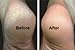 Dew Drops Miracle Hand and Foot Cream for Cracked Hands and feet