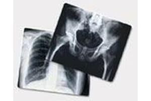 THE AGFA CORPORATION INCORPORATED PT# -EBA6A X-Ray Film Blue 800 Speed 10x12 100/Bx by, Agfa Corporation