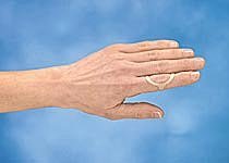 3 point products p1008-4 oval-8 finger splint, size 4