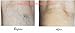 Skin Beauty Solutions 4oz -Pro-K Vitamin K Cream Professional Strength- Rosacea Capillaries, Thread Spider Varicose Veins, Puffy Dark Under Eye Circles. Guaranteed to Work