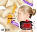 Neck Stretcher- Cervical Neck Traction Device | Neck Brace for Cervical Neck Traction Fast Neck Pain Relief Aligns Spine and Relieves Pressure from The Neck and Shoulders You Will Feel The Difference