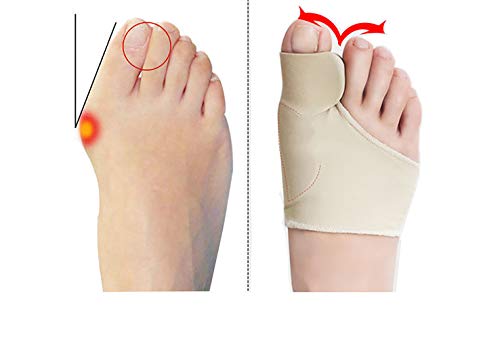 Bunion Corrector Sleeve with Gel Pad, Bukm Elastic Bootie Bunion Relief Cushions - Hallux Valgus Pain Relief - Shoe Friction Protector - Adjustable Size for Men and Women (2 Pack)