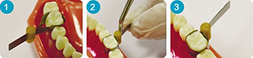 Dental combined matrices matrix kit EXTRA with movable fixator 20 pcs