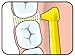 TePe Interdental Brush Angle, Angled Dental Brush for Teeth Cleaning, Pack of 6, 0.40 mm, Extra-Small/Small Gaps, Pink, Size 0