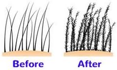 Hair Genetics Hair Fibres Refill Packs, Fill in Bald Spots & Thinning Hair for a Fuller Look Natural Colours - Image 5