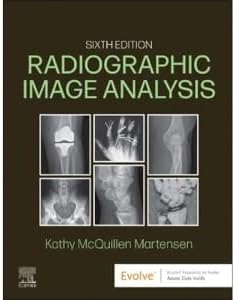 Workbook for Radiographic Image Analysis: 9780323930680: Medicine