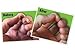 Dew Drops Miracle Hand and Foot Cream for Cracked Hands and feet