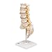 3B Scientific A76/5 Lumbar Spinal Column with Dorso-Lateral Prolapsed Intervertebral Disc, 13.4