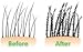 Hair Building Fibers 50 Gram Refill Plus 4.1 oz Strong Fiber Lock Spray - Refill Your Existing Bottle. Finally Hair