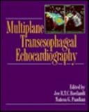 Multiplane Transesophageal Echocardiography, , 0443079501