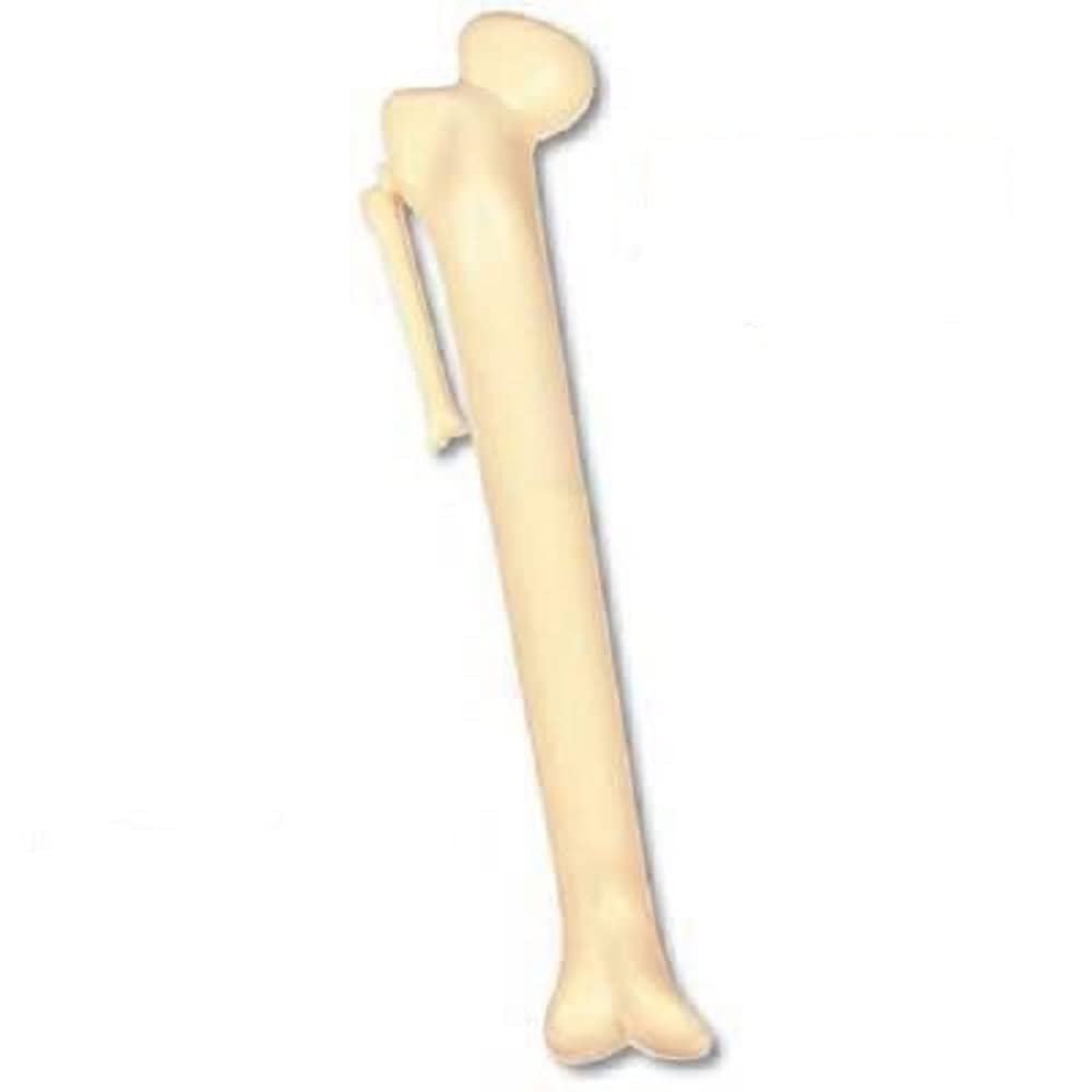 6 Novelty Bone femur pens ideal for Nurse or Healthcare Professional
