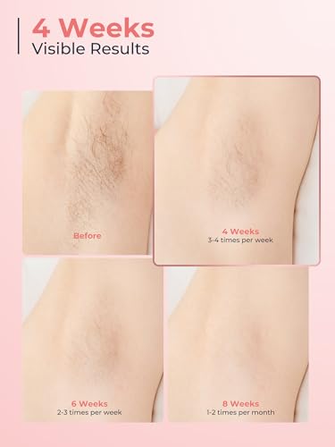 Beauris IPL Laser Hair Removal Device for Women Men, Painless Ice-Cooling Hair Remover Machine, 3 Functions, 9 Levels, At-Home Salon & Long Lasting Results for Face Bikini Line Armpits Leg Body, Rose