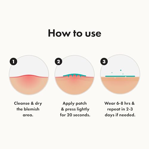 Mighty Patch Hero Cosmetics Micropoint Acne Pimple Patches, 8 Ct | For Early Stage Zits & Hidden Blemishes; Hydrocolloid with Salicylic Acid, Niacinamide, Cica; 395 Micropoints; Acne Stickers