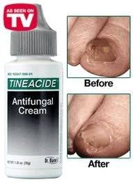 Dr. Blaines Tineacide Antifungal Cream – 1.25 oz, Pack of 5