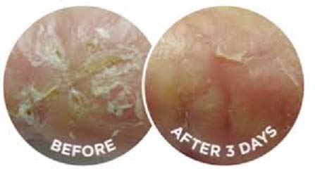 dermal very dry skin cream