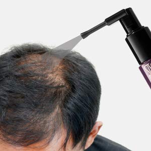 Style Edit Instant Hair Building Fibers, for Thinning Hair or Bald Spots, Hair Loss Concealer, for Men And Women (Multiple Colors Available)