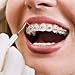 Oxyfresh Pro Relief Dental Gel: Soothes Sensitive Gums - Promotes Healing - Best for: Sore Gums, Tooth Extraction, Oral Surgery, Braces, Dentures, Canker Sore, Etc. - Dentist Recommended - 4 oz